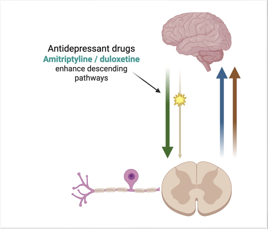 Diagram of drug management of nociplastic pain